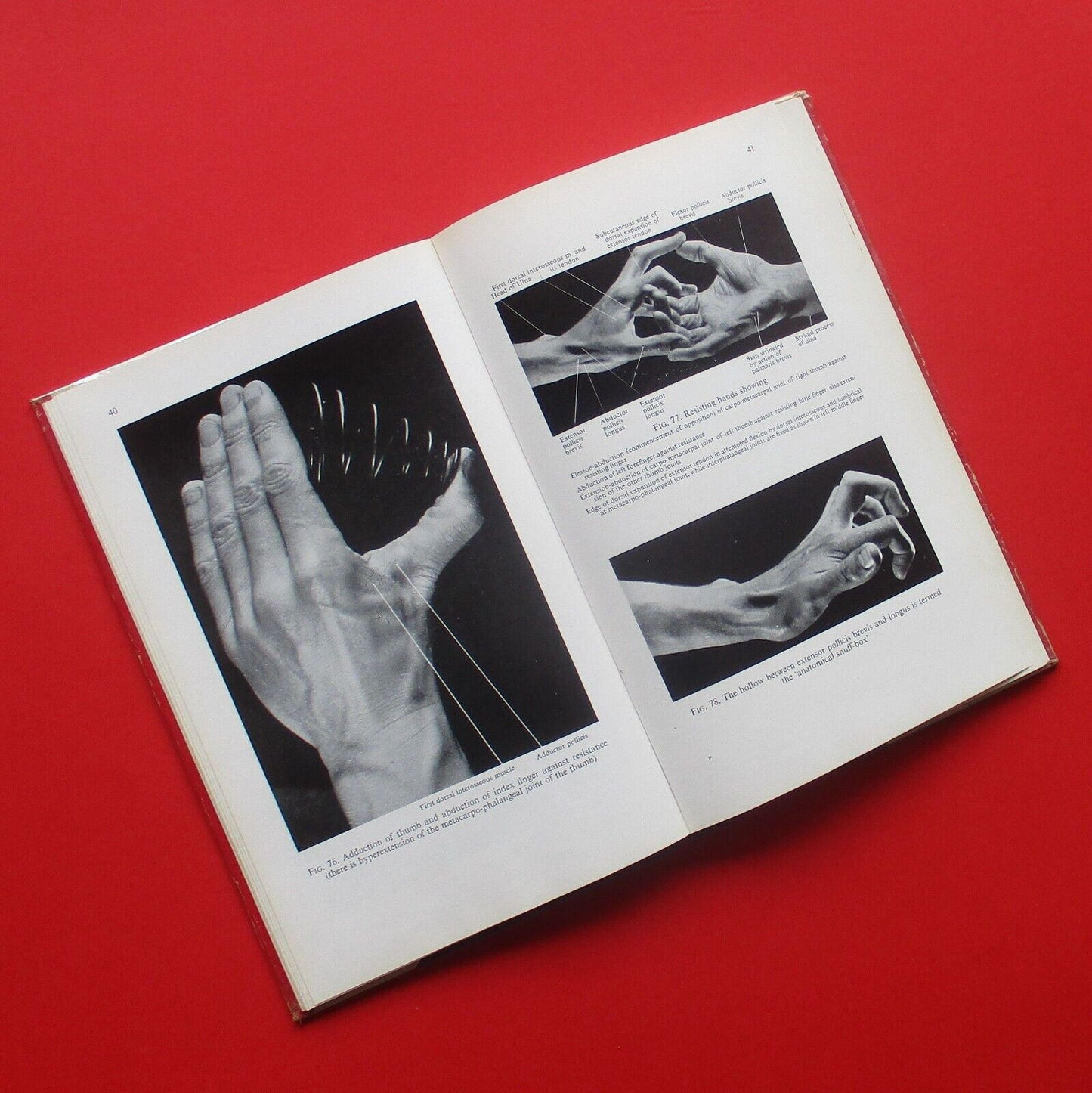 Living Anatomy A Photographic Atlas of Muscles by R. D. Lockhart 1962 Hardcover